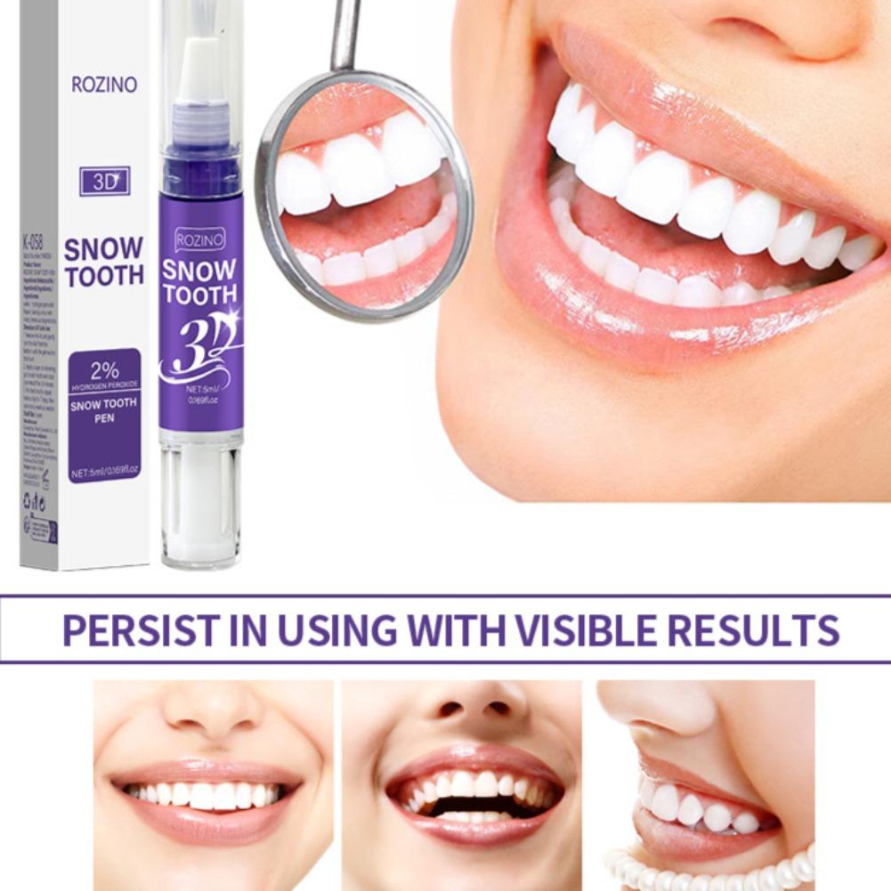ปากกาดูแลช่องปากและฟันสำหรับทุ - Teeth Whitening Pens บทวิจารณ์และราคา