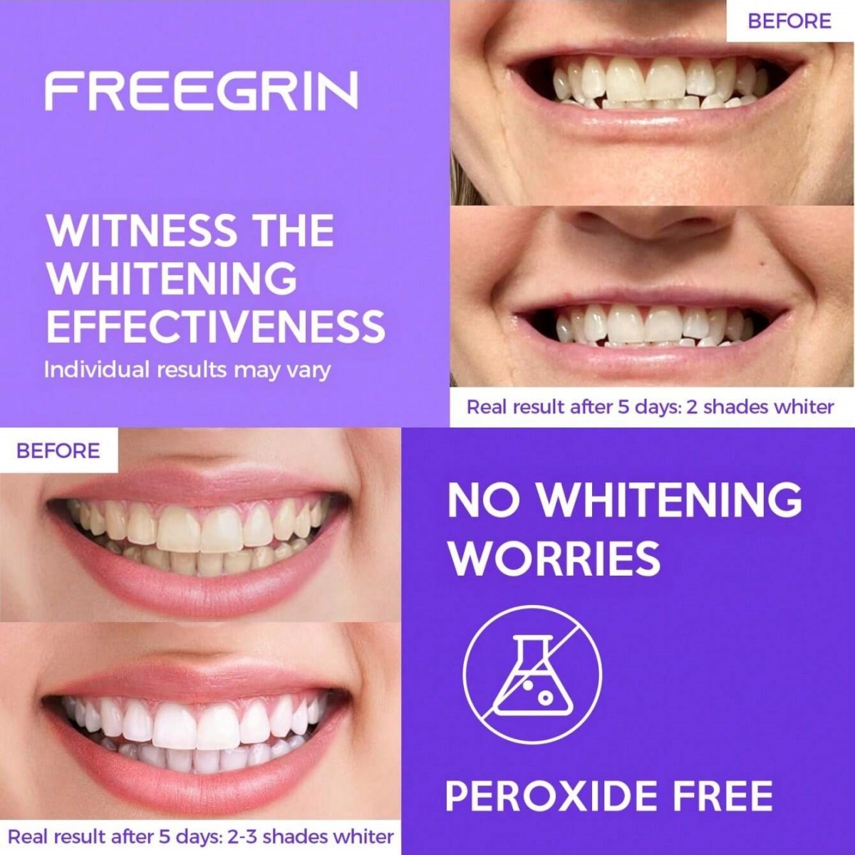 ดีลักซ์สติกเกอร์ฟอกสีฟัน 7/14/ - Teeth Whitening Near Me บทวิจารณ์และราคา