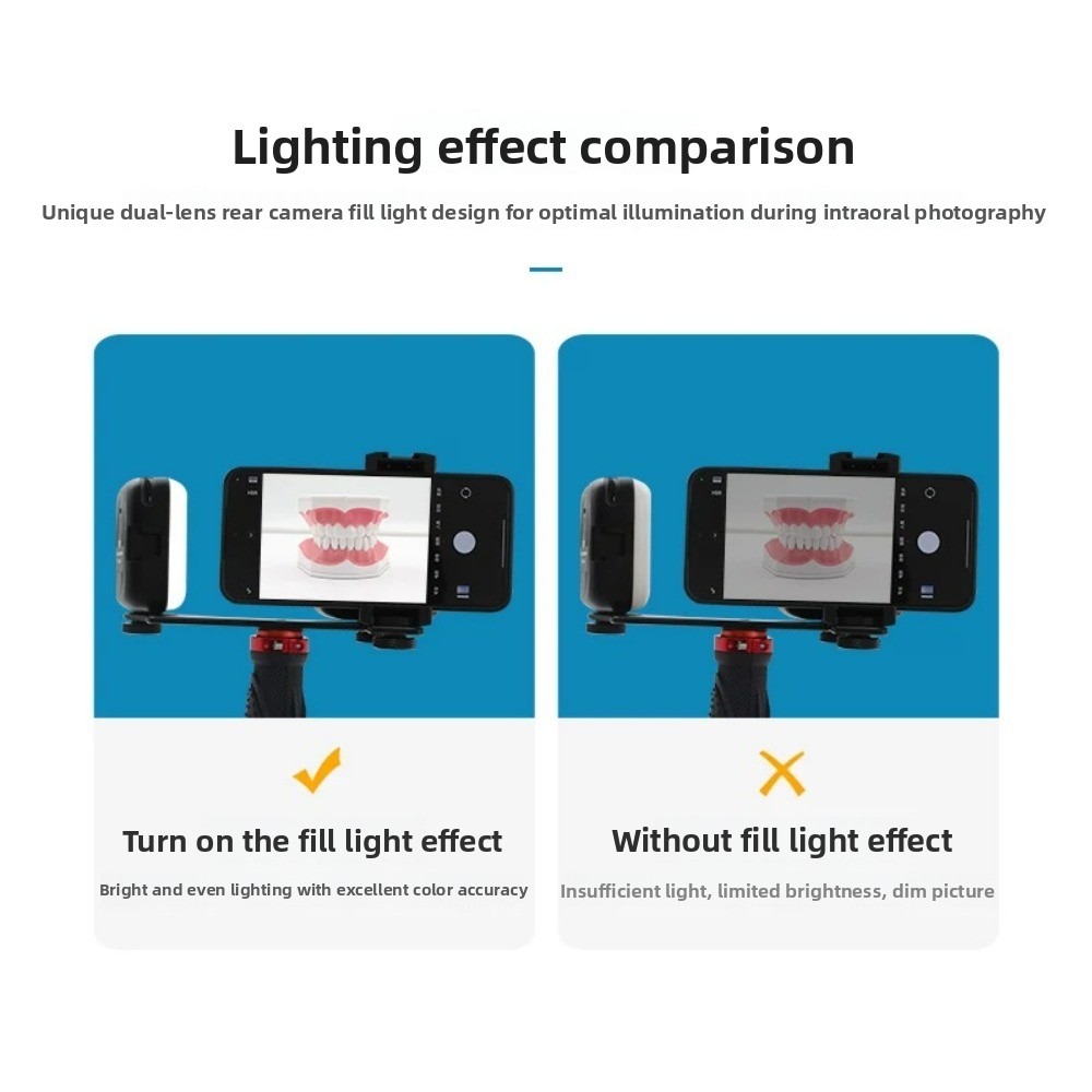 ไฟถ่ายภาพทางทันตกรรม, แฟลช LED - Teeth Whitening Kit บทวิจารณ์และราคา