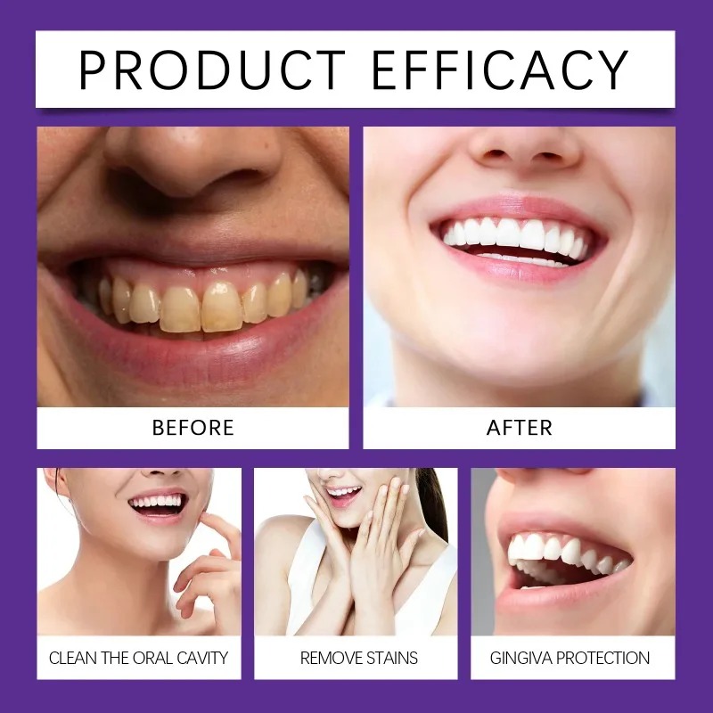 ผงแร่ฟื้นฟูฟันสีม่วง ผงยาสีฟัน - Teeth Whitening Near Me บทวิจารณ์และราคา